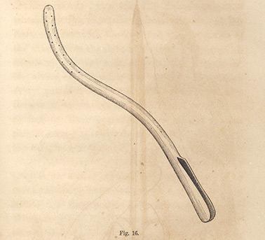 Sims Speculum