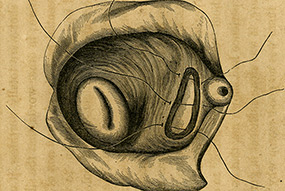 Sims Sutures